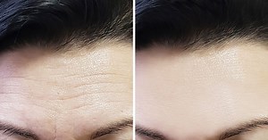 Anti-rides : voici la recette du masque “effet Botox” 100% naturel qui fait le buzz sur TikTok