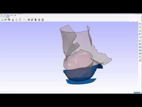 Delcam OrthoModel Pro Demo