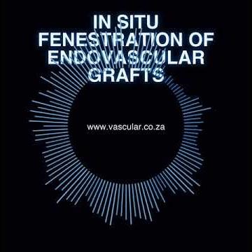 MET - 57 - In-Situ Fenestration of Endovascular Grafts - Brief