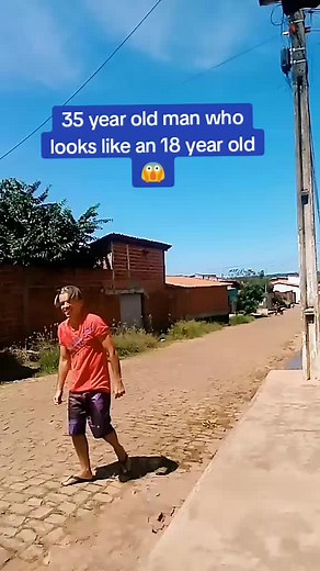 35 Year Old Man Who Looks Like an 18 Year Old - Mind-Blowing Transformation!