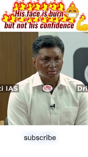 🔥 Burned Face, Unbroken Spirit 💪 | UPSC Interview Shock