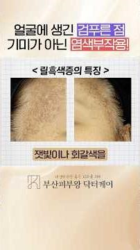 헤나 염색 후, 못보던 기미(?)가 생겼다면?! 릴흑피증, 릴흑색증 의심해보세요!💥