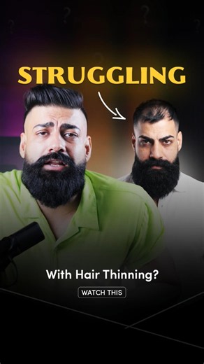How to prevent hair loss (balding solutions)