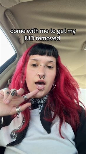 IUD Removal Experience: What to Expect