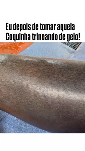 TUDO ISSO PESSOAL on Instagram: "Tomar Coca-Cola e soltar aquele arroto gigante não é um superpoder, é pura ciência trabalhando no modo turbo. A explicação é simples e ao mesmo tempo hilária: a Coca-Cola é uma das bebidas com maior concentração de dióxido de carbono, o famoso gás que transforma cada gole em um pequeno vulcão interno. Assim que você bebe, o gás entra no estômago e encontra um ambiente quente e em movimento, o que faz as bolhas expandirem rápido. Como o corpo precisa liberar essa