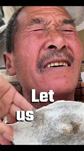 Very painful vexxing 🤯