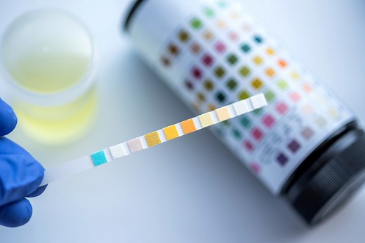 7 Things the Color of Your Pee Says About Your Health, According to a Doctor