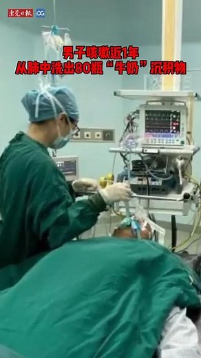 杭州一男子久咳不愈，竟在肺里洗出了80瓶“牛奶”,大叔洗肺- 抖音