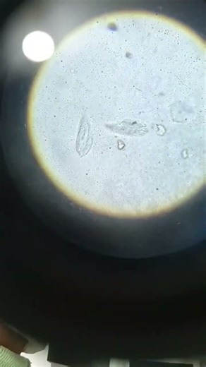 #urine microscopic examination#🔬🔬🔬💉💉🧪🧪🌡️💊