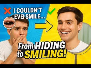 Lost a Front Tooth? See How Our Flexible Flipper Restored His Smile & Confidence”