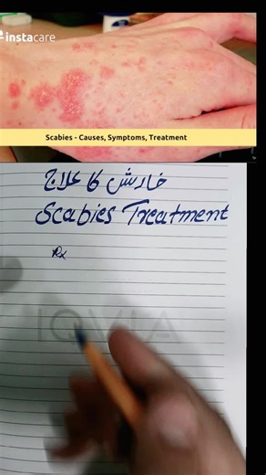 Effective Scabies Treatment Options for Quick Relief