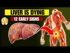 LIVER IS DYING 12 Weird Signs of LIVER DAMAGE (Warning Signs!)