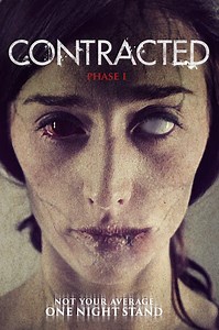 Contracted: Phase I