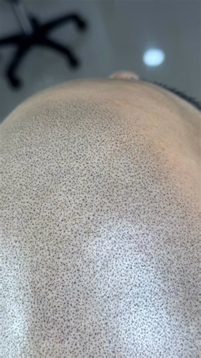 Microtech_Micropigmentacion on Instagram: "👉🏻🙏💯"