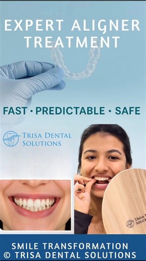 🦷 Expert Aligner Treatment by Certified Professionals #dentalaligners #alignersforteeth