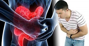 Effects and complications of Hiatal Hernia - by FoodnHealth.org