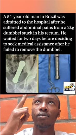 Man in Brazil hospitalized with a 2kg dumbbell stuck in his rectum. #shorts #Brazil #Hospital