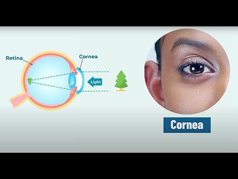 Corneal Surgery Explained: Types & Procedures for Improved Vision