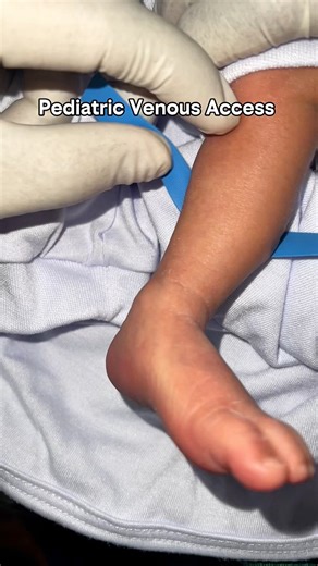 Pediatric Venous Access #nurses #nursingstudent #studentnurse | Nurse Darwin