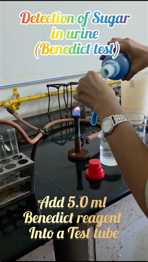 Urine analysis#sugar detection test#practical #glucose #laboratory #students #dailyshorts