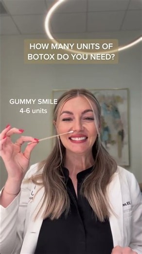 Average Botox Units by Treatment Area