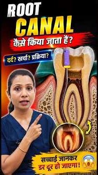 The Whole Truth About Root Canals! | Root Canal Step By Step | RCT #trending #shorts #rootcanaltr...