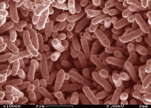 Shewanella putrefaciens ~ Everything You Need to Know with Photos | Videos