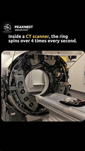 The Hidden Speed Inside a CT Scanner 🤯#CTScanner #MedicalTechnology #Science #Engineering
