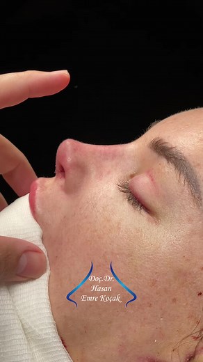 Natural Barbie: Embracing Australian Beauty