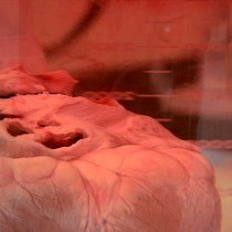 Video: Procedure for Decellularization of Porcine Heart by Retrograde Coronary Perfusion