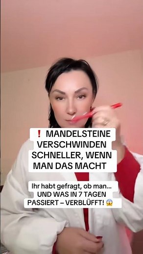 Mandelsteine loswerden – einfacher Schritt für saubere Mandeln!😱 #gesundheit #liebe #arzt #medizin