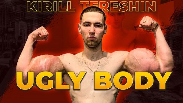 Synthol Shock: Unveiling Extreme Muscle Madness!