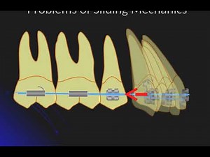 bowing effect in sliding mechanic