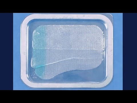 Progripᵀᴹ Laparoscopic Self Fixating Anatomical Mesh - Folding Demonstration