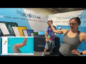 Elbow scanning with MSoft and the Einstar scanner