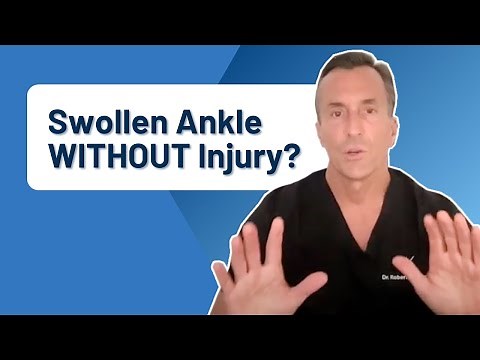 What Causes Ankle Pain and Swelling WITHOUT Injury?