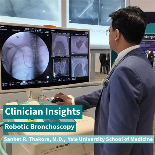 Clinician Insights by Sanket R. Thakore, M.D.! Gain exciting insights about robotic bronchoscopy and how the Ziehm Vision RFD 3D increases diagnostic confidence and patient safety during the procedures. Dr. Thakore is the Director of the Robotic Bronchoscopy Program and Interventional Pulmonologist at Yale University School of Medicine. His research focuses on improving lung cancer outcomes. | Ziehm Imaging