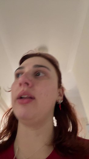 Understanding Broca's Aphasia: Symptoms and Insights