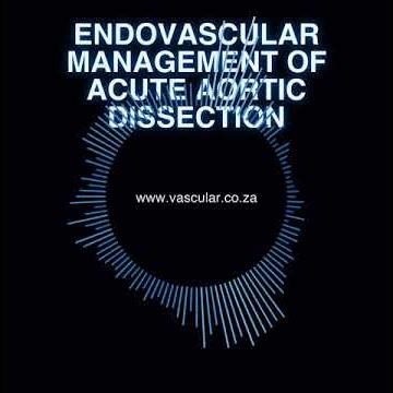 MET - 63 - Endovascular Management of Acute Aortic Dissection - Brief
