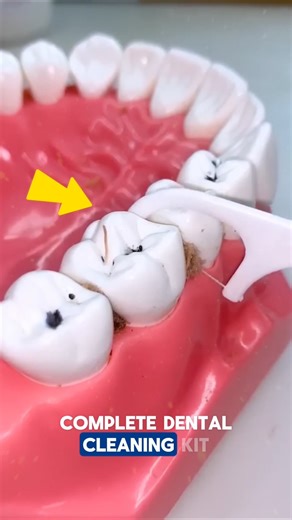 Dental Cleaning Kit