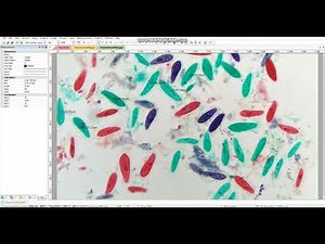 ImageView Microscope Camera Software: Reports