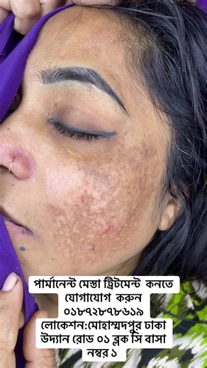 #টিকটক_বাংলাদেশ_অফিসিয়াল #বাংলাদেশি_ভাইরাল_টিকটক_ #1millionaudition #টিকটক_বাংলাদেশ_অফিসিয়াল🇧🇩🇧🇩🇧🇩 @White House Beauty Parlour 3 @Aesthetic Skin Care