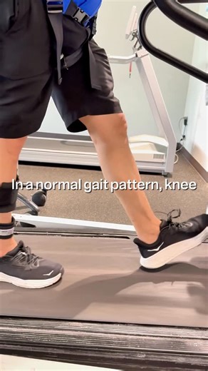 Dr. Chris McElderry | Neurologic Clinical Specialist on Instagram: "😡 Anecdotally, I feel the hamstrings pose one of the biggest challenges to try and restore recruitment and improve strength post-stroke. 😅 This can lead to a knee extension thrust during stance phase, lack of knee flexion during swing phase (although knee flexion is mainly passive with adequate force production from the plantar and hip flexors along with inertial forces and gravity. 🤔 Questions I constant