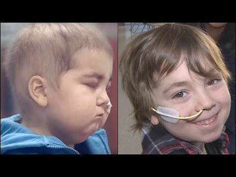 Our Toronto: Child from SickKids commercial now full of energy