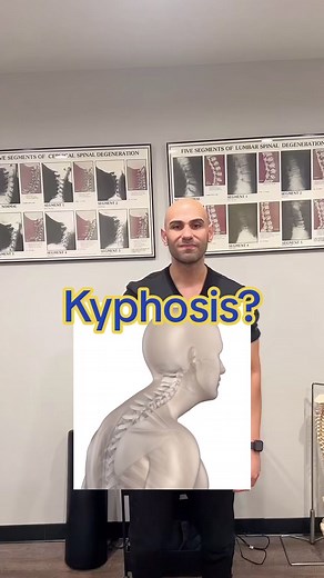 Kyphosis / Bad Posture? Try this and share! #kyphosis #posture #brueggers #badposture #roundedshoulders #techneck #forwardheadposture #lifehacks #tips #viral | Prime Performance Chiropractic & Wellness Clinic