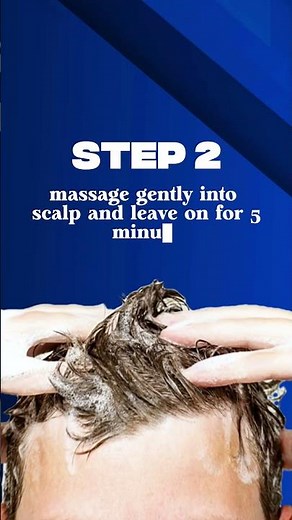 How to Use Nizoral 2% Shampoo for Dandruff