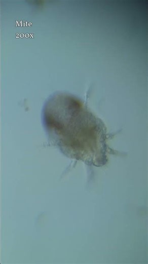 Mite under the microscope #microscopy #science #nature #microscope