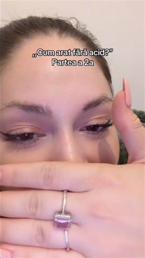 Facem partea a 3a sa vedeti cum arata topite de tot, cand aveam o linie?😂 #viral #shorts