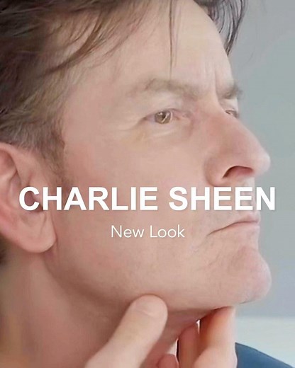 Dr. Yan Trokel - Y LIFT® on Instagram: "🎬 Unveiling Charlie Sheen’s SurgYlift Results “SurgYlift is giving me the confidence I haven’t felt in a long time,” declares Charlie Sheen (@charliesheen). Today, we reveal the extraordinary results of Charlie Sheen’s Y LIFT and SurgYlift procedures. Previously, his “turkey gobbler” neck, as noted by Fox News, impacted how he appeared on camera. Today, that moment is a thing of the past, as Charlie Sheen emerges with newfound confidence after his SurgYli