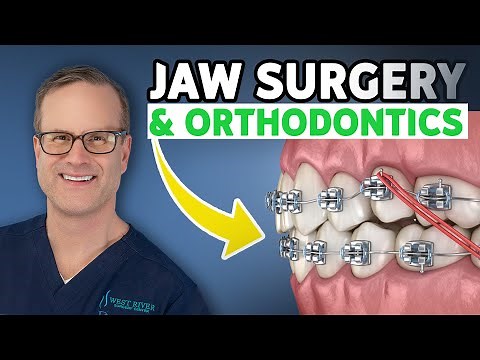 Understanding Orthodontic Protocol Before and After Jaw Surgery | Dr. Derek Steinbacher